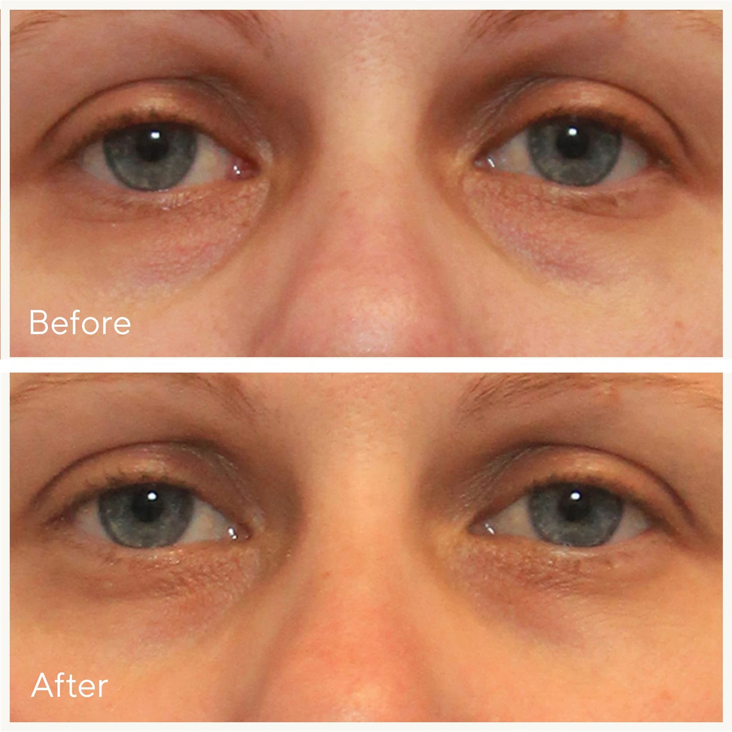 Murad Environmental Shield Vita-C Eyes Dark Circle Correcteur 15ml