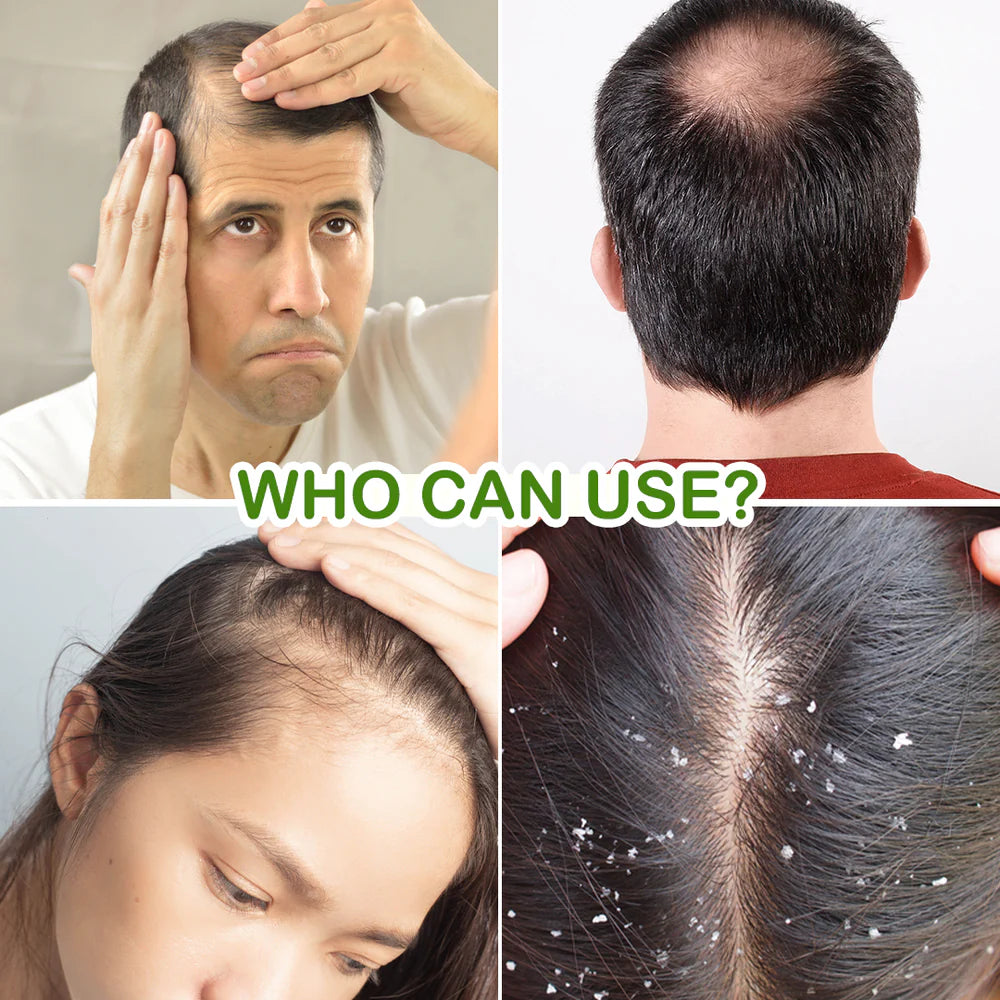 Jovees Rosemary Water Hair Growth Spray | Controls Hair Fall | Increases Hair Density | Fights Dandruff | Lightweight & Non-Greasy | For Men & Women 200ml