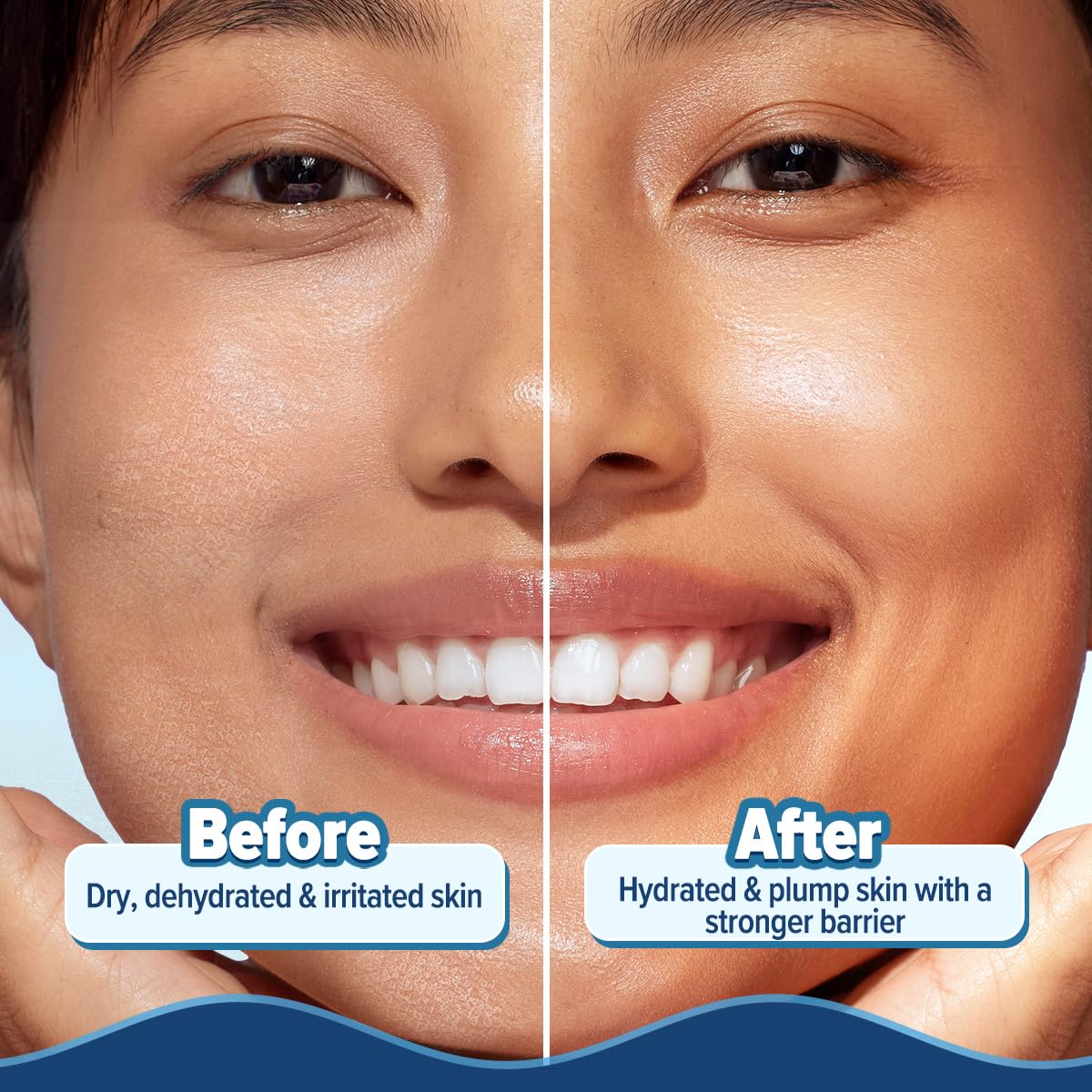 Aqualogica 5 Barrier+ Hydra Gel Moisturizer with 5 Essential Ceramides & Avocado | 24-Hour Intense Hydration | Weightless Water-Like Gel Texture | Non Sticky & Quick Absorbing for Healthy Skin Barrier | 200 g