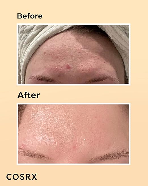 Cosrx Advanced Snail 96 Mucin Power Essence (100 ml)