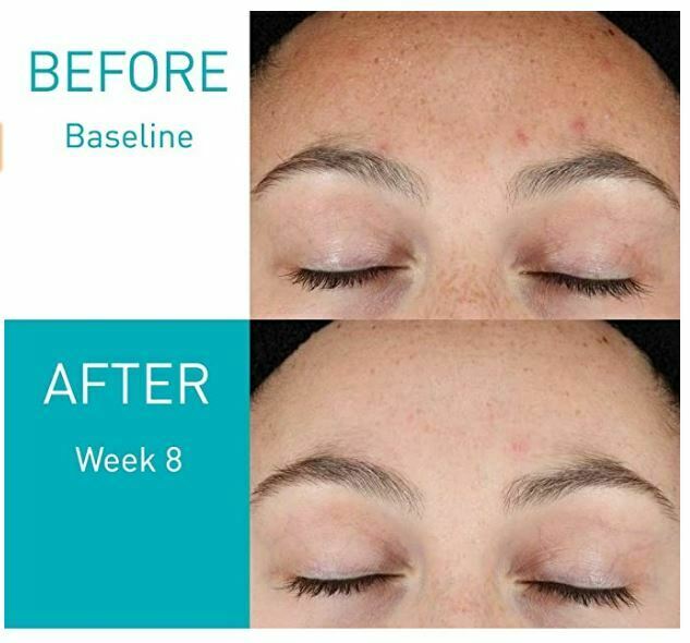 CeraVe Resurfacing Retional Serum 30ml