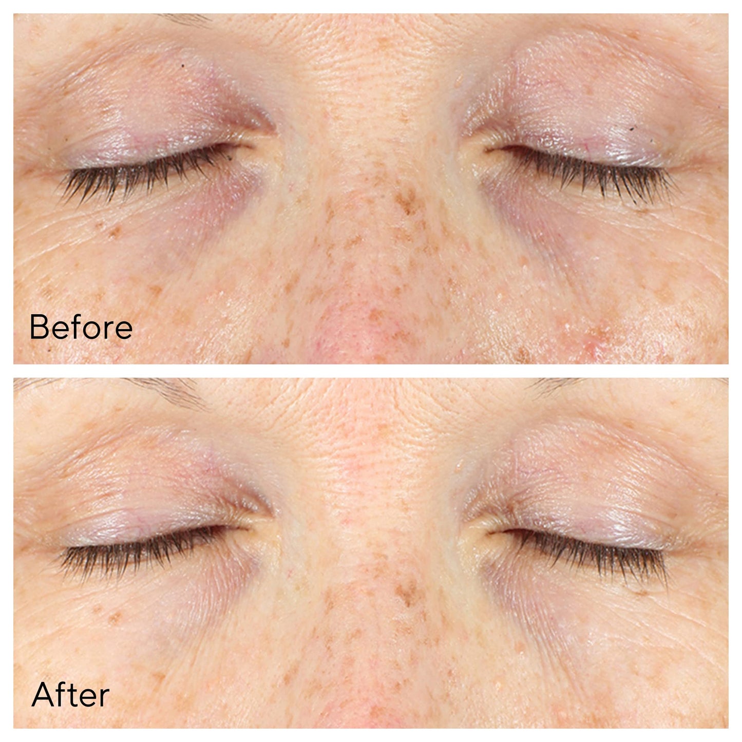 Murad Environmental Shield Vita-C Eyes Dark Circle Correcteur 15ml