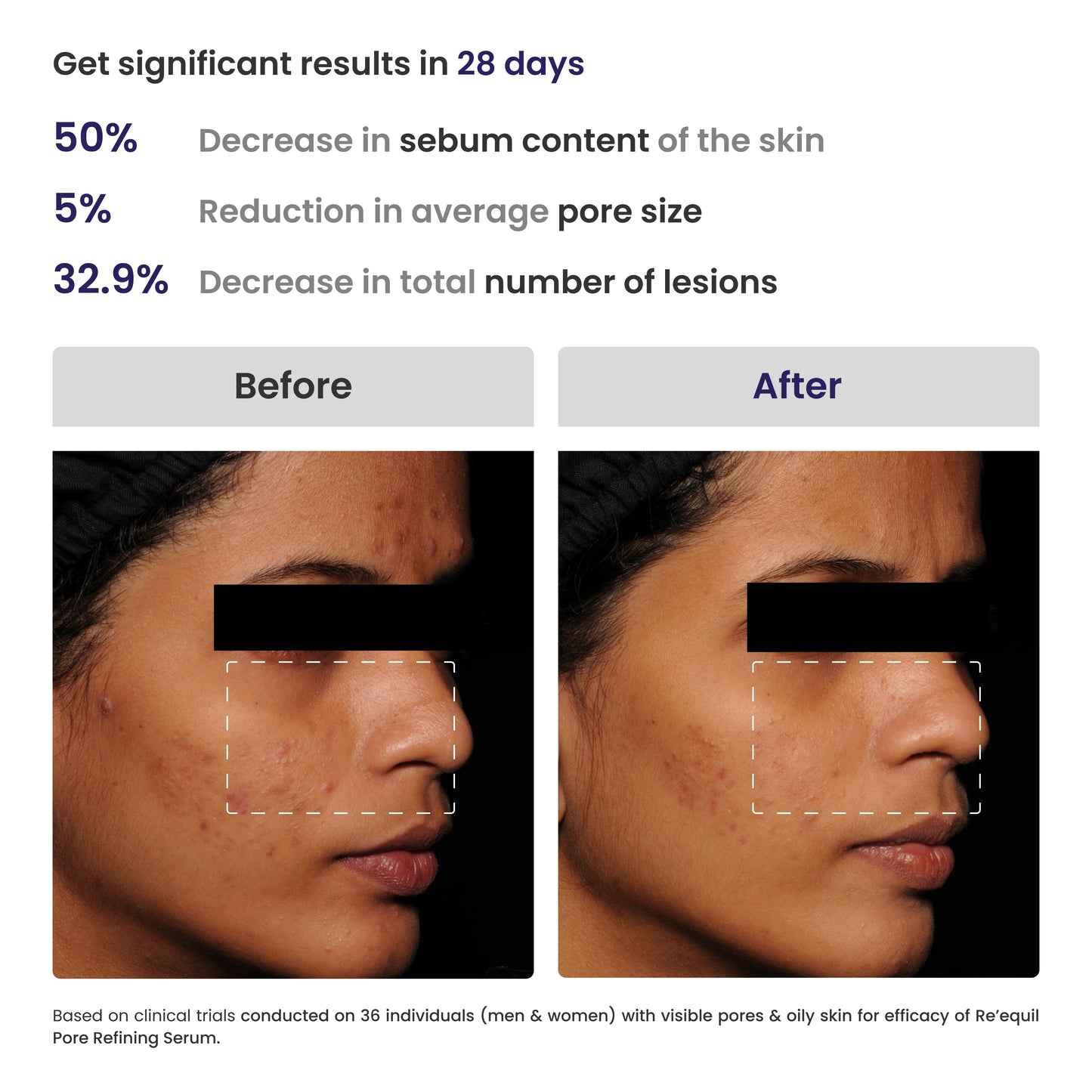 Re'equil Pore Refining Serum 25ml