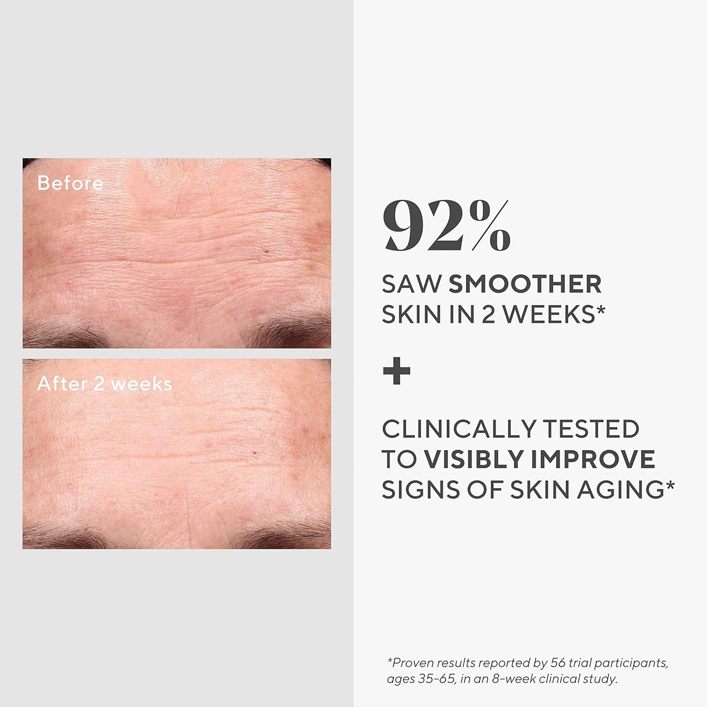 Murad Resurgence Retinol Youth Renewal Serum 30ml