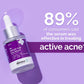 The Derma co 2% Salicylic Acid Serum - 30ml