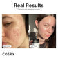 Cosrx Niacinamide 15% Face Serum 20ml | Minimizing Pores & Sebums | Blemish Treatments for Discoloration | Dark Spots | Enlarged Pores | Artificial Fragrance-Free | Parabens-Free
