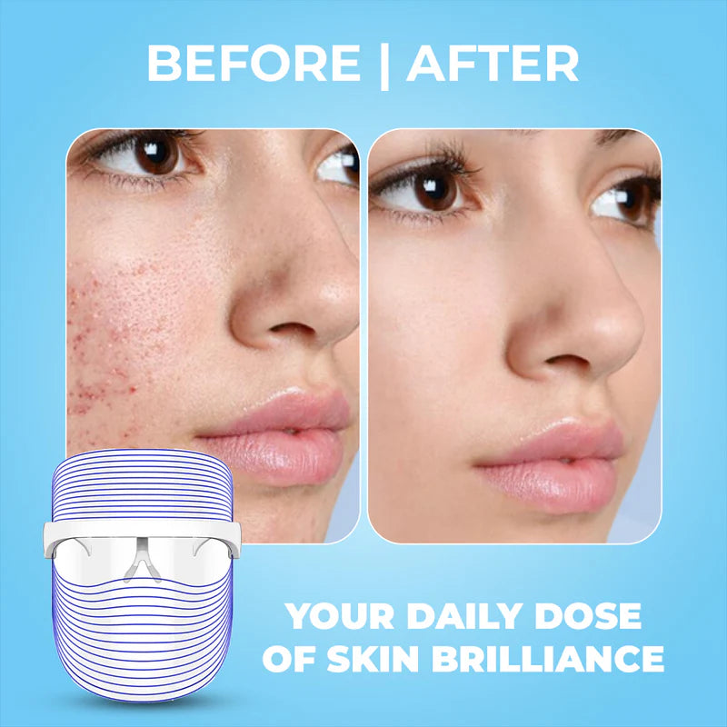 WINSTON LED LIGHT THERAPY FACE MASK TRANSPARENT & WHITE WITH 3 LIGHT MODES