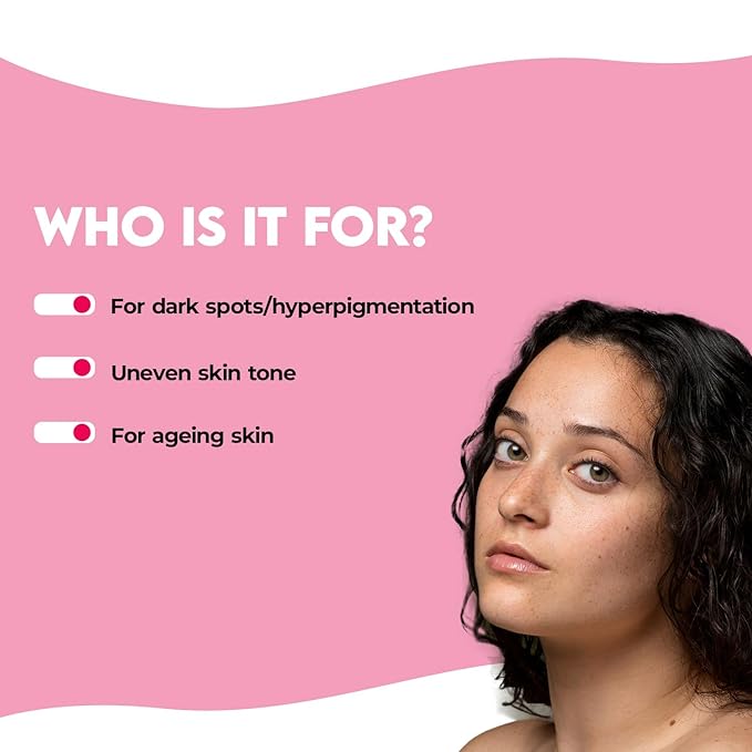 Jovees Herbal 2% Alpha Arbutin Pigmentation Cure Serum With 1% Kojic Acid, Cica Extract & Vitamin B3 | Reduces Blemishes & Improves Skin Texture | Brightens Skin | For All Skin Types | 30 ml