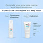 Sebamed Clear Face Cleansing Foam for Acne prone Skin 150 ml I pH 5.5 I Gentle, Effective hydrating cleanser for pimples | Face wash |men & womenl Oil Free l Clinically proven l Toxin free